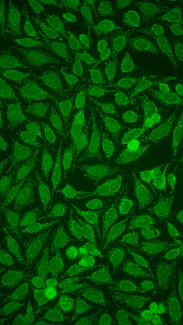“La luce della scoperta” – Microscopia fluorescente