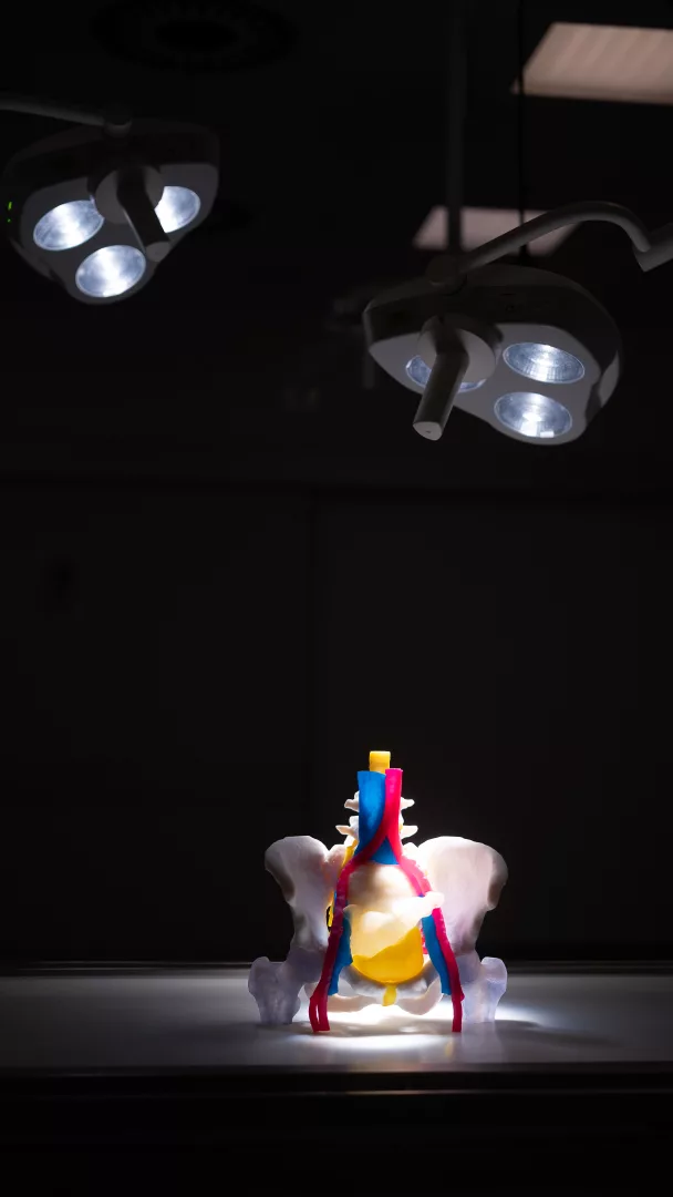 Modello Anatomico Operabile stampato in 3D Polyjet per Pre Planning Chirurgico Complesso